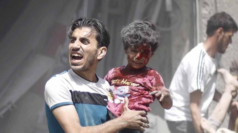 At least 20 civilians -- including four children -- were killed in Douma on Saturday, in addition to 17 civilians in other battlefront towns, said the Observatory. (Photo: Representational/ AFP)