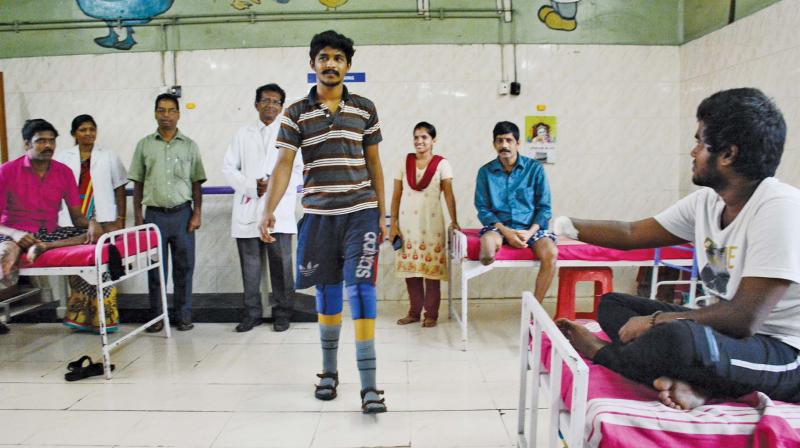 Vijay after receiving prosthetic legs at the Kilpauk Medical Hospital (Photo: DC)